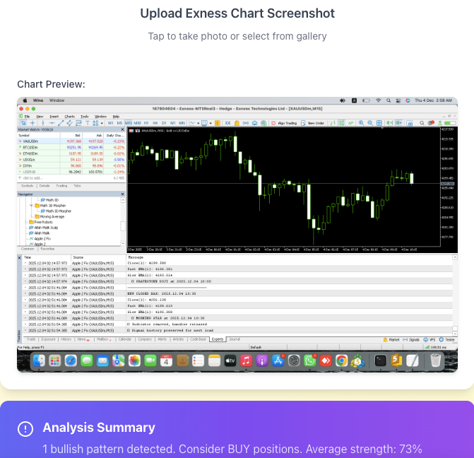 XAU/USD Entry Detection